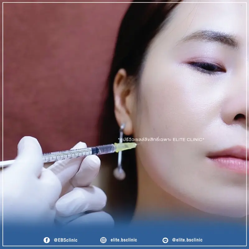 Botox