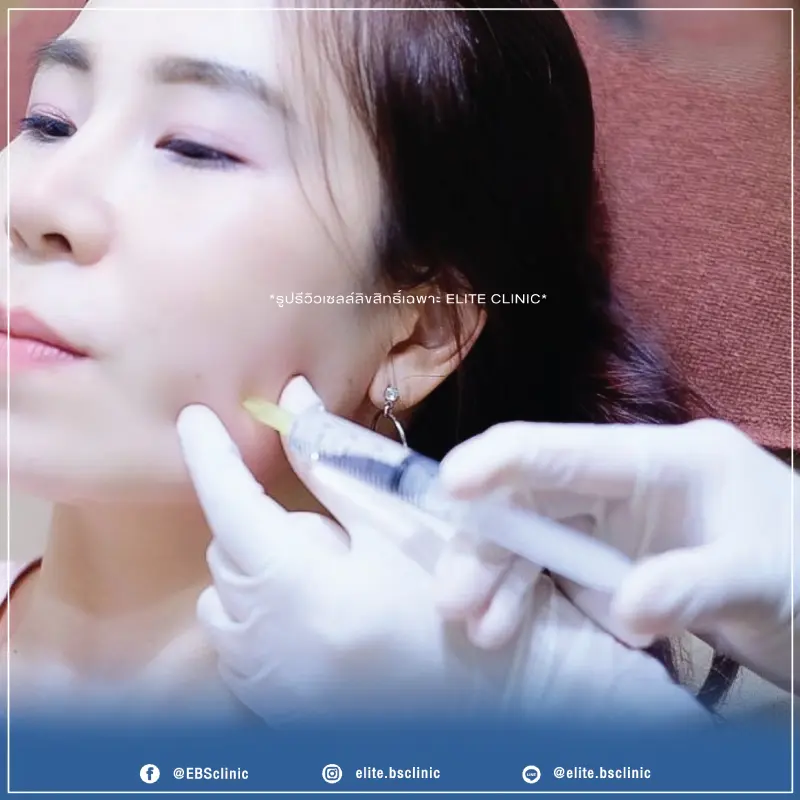 Botox