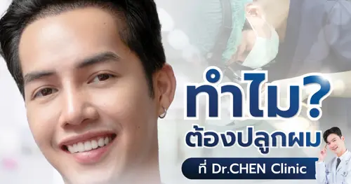 ปลูกผม รักษาอาการผมร่วง ผมบาง 