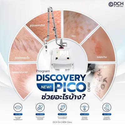 PICO Discovery เลเซอร์เครื่องแท้ จากอิตาลี.. 