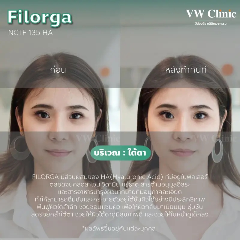 Filorga