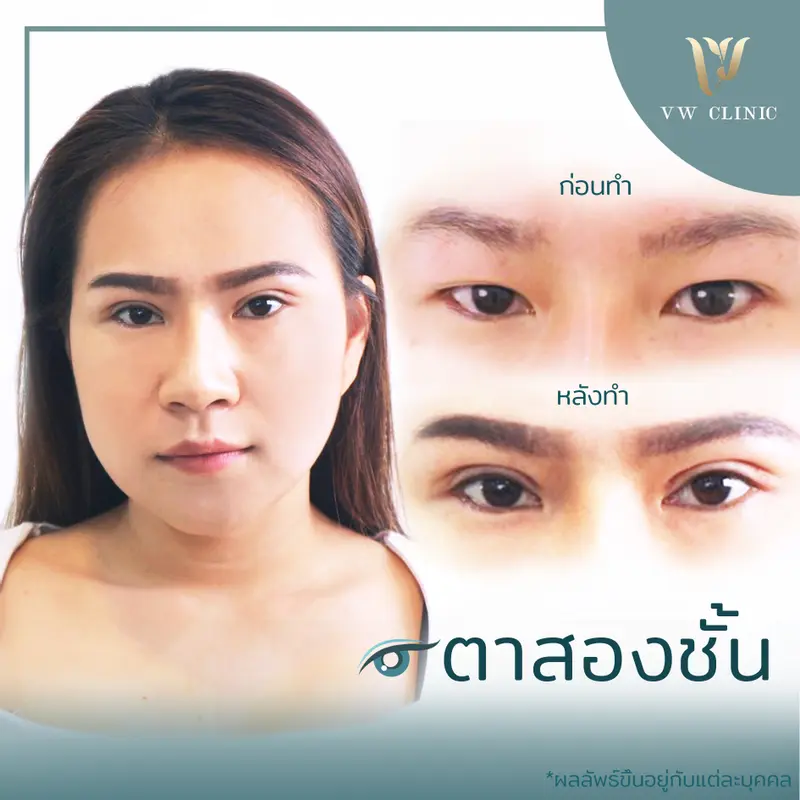 ตาสองชั้น