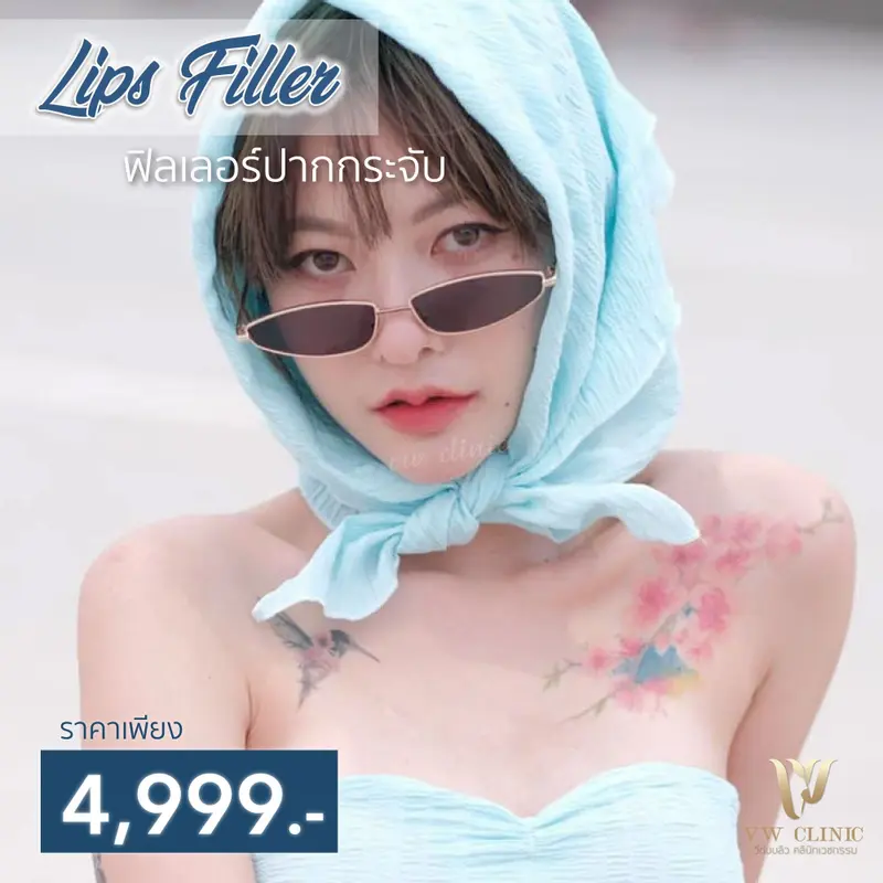Filler ปาก