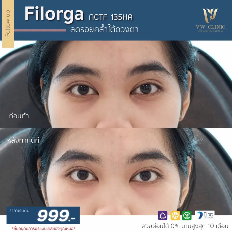 Filorga