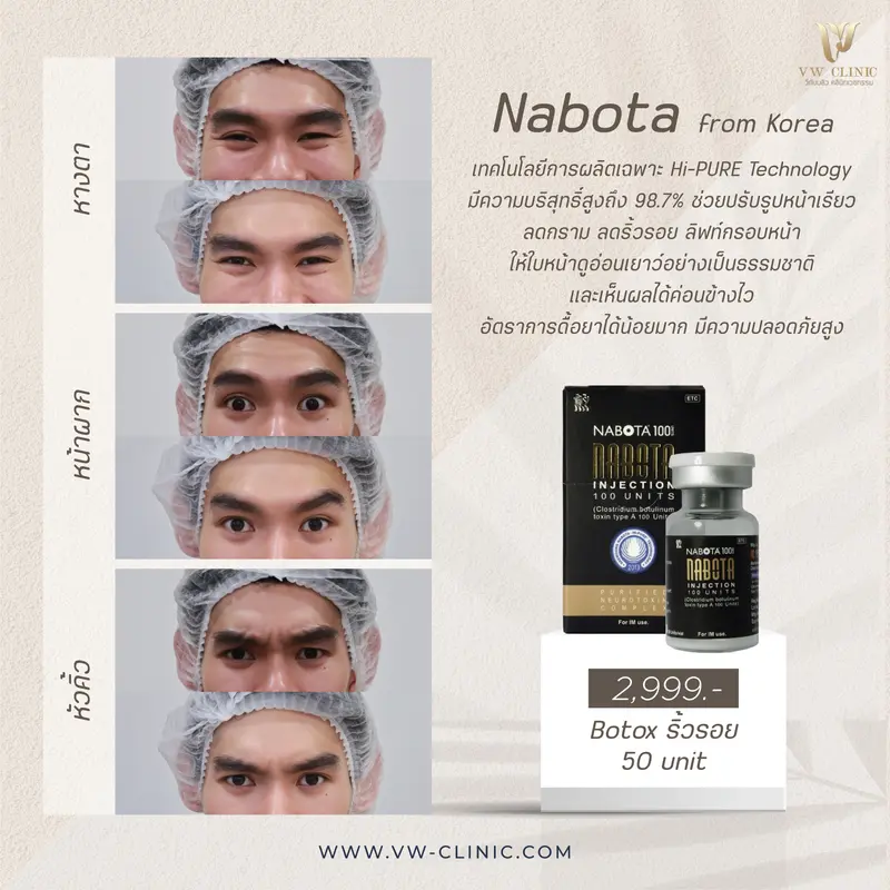 Botox ริ้วรอย