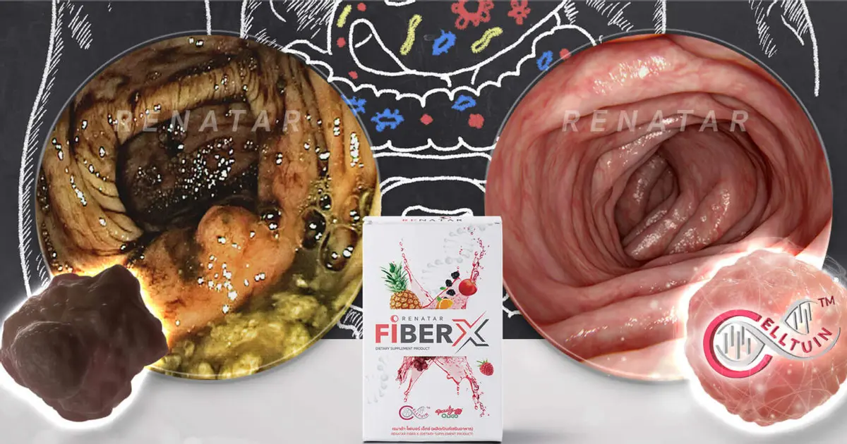 ถาม-ตอบ และวิธีทาน Renatar Fiber X สุขภาพดีถึงระดับเซลล์