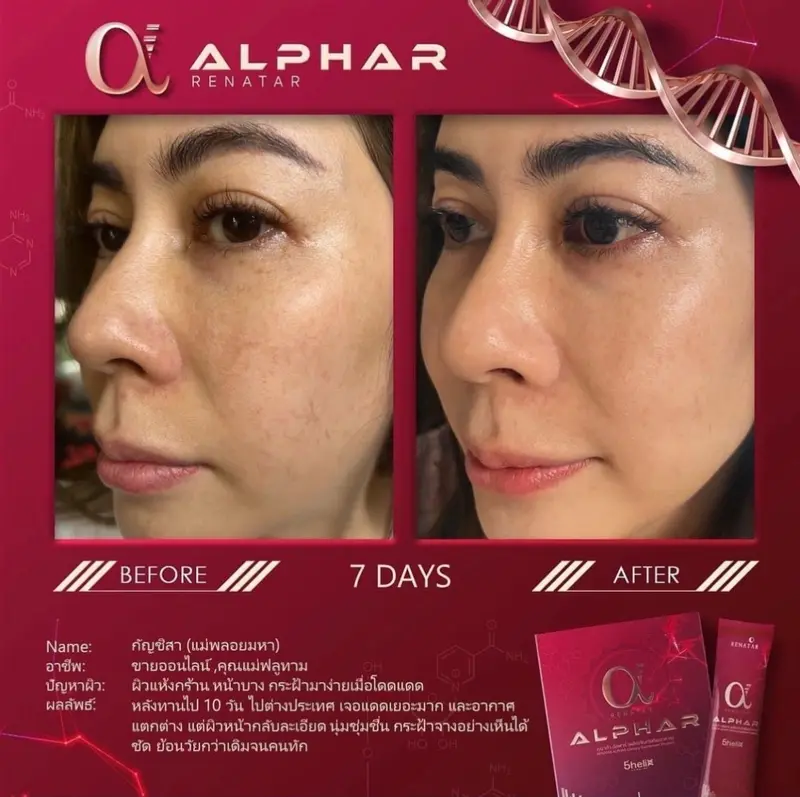รีวิวก่อนและหลังทาน Renatar Alphar