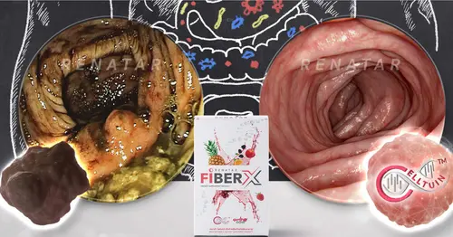 ถาม-ตอบ และวิธีทาน Renatar Fiber X สุขภาพดีถึงระดับเซลล์
