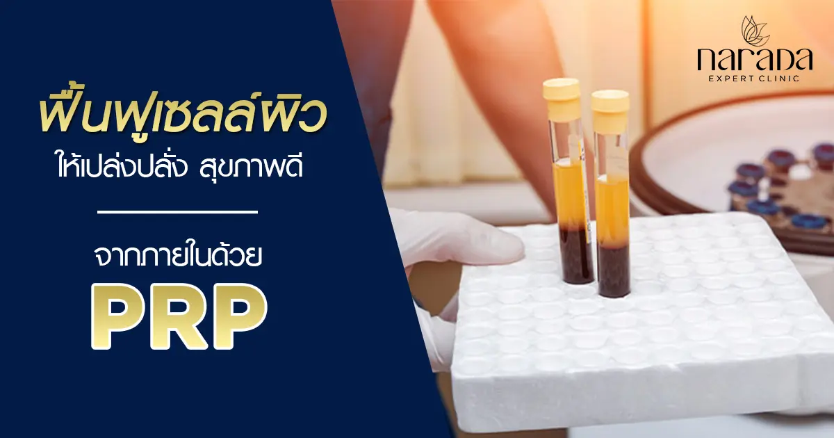 ฟื้นฟูเซลล์ผิวให้เปล่งปลั่งสุขภาพดีจากภายในด้วยเกล็ดเลือดของตัวเอง โดย PRP (Platelet Rich Plastma)