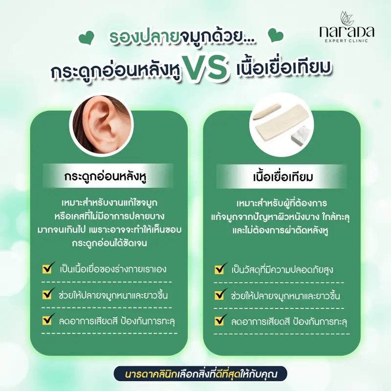 รองปลายจมูกด้วย กระดูกอ่อนหลังหู vs เนื้อเยื่อเทียม