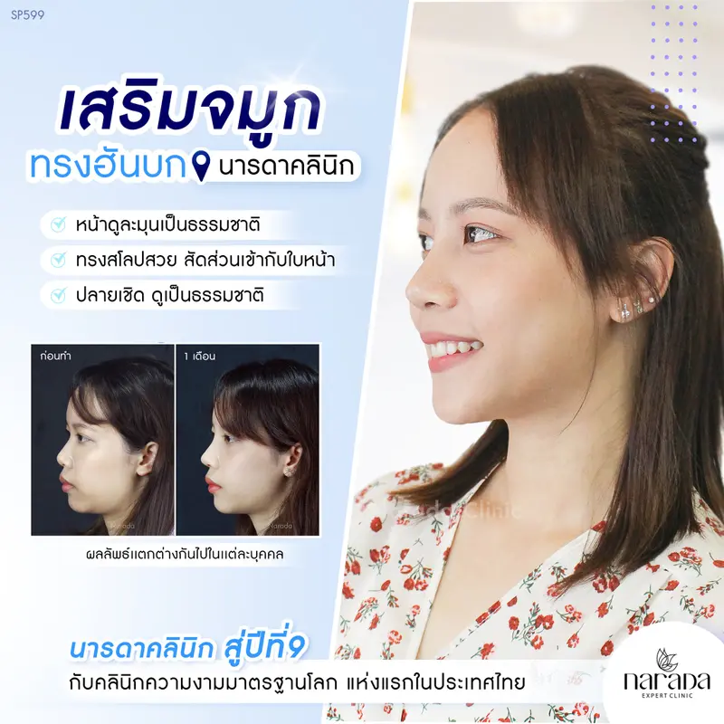 🌈ทรงฮันบกเทคนิค Semi-Open เฉพาะที่ นารดาคลินิก🌈