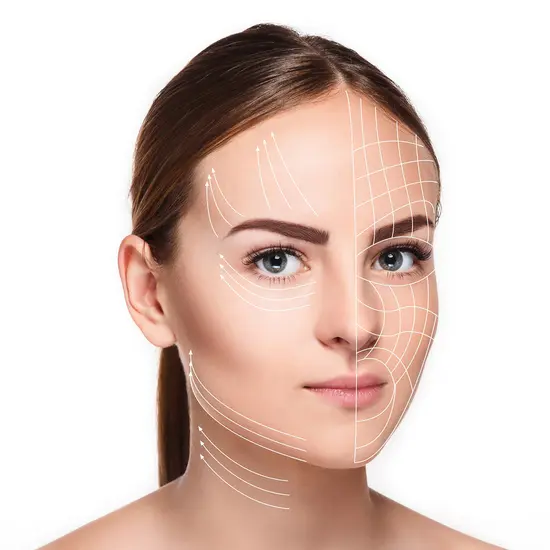 ร้อยไหม (Thread Lift) 