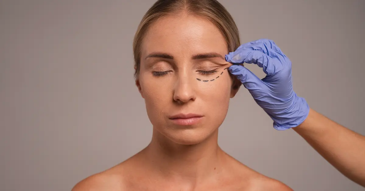 Subbrow Lift คืออะไร? เทคนิคยกหางตาให้ดูอ่อนวัยโดยไม่เปลี่ยนชั้นตา