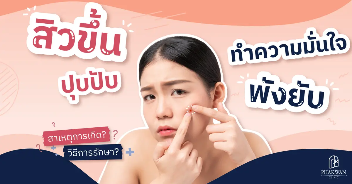 ชนิดของสิวมีอะไรบ้าง?
