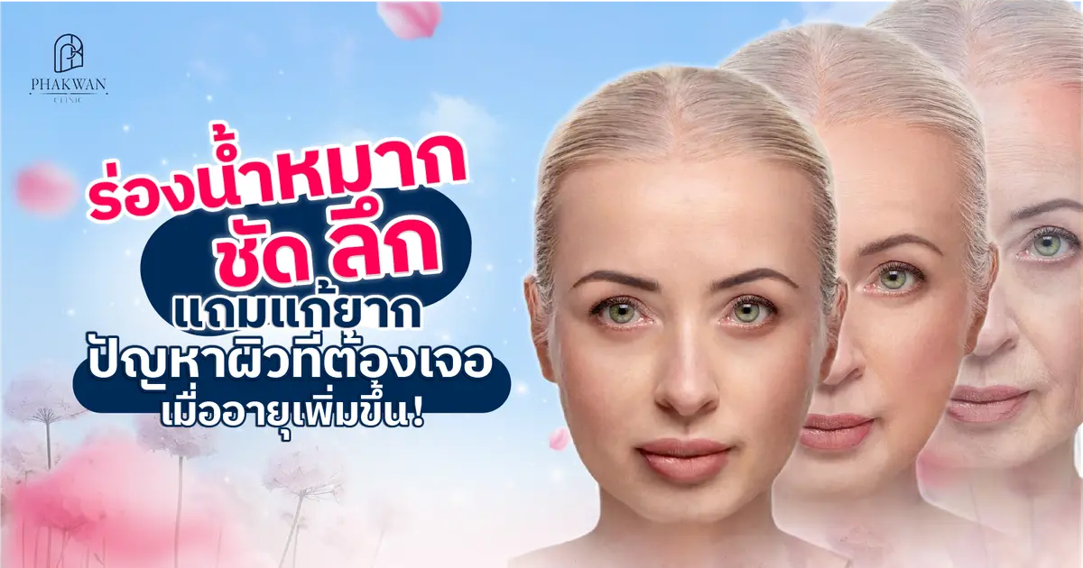 ปัญหาร่องแก้มลึก ร่องน้ำหมาก มุมปากตก แก้ไขยังไงเห็นผลดีสุด?