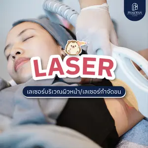 Laser เลเซอร์กำจัดขนถาวร