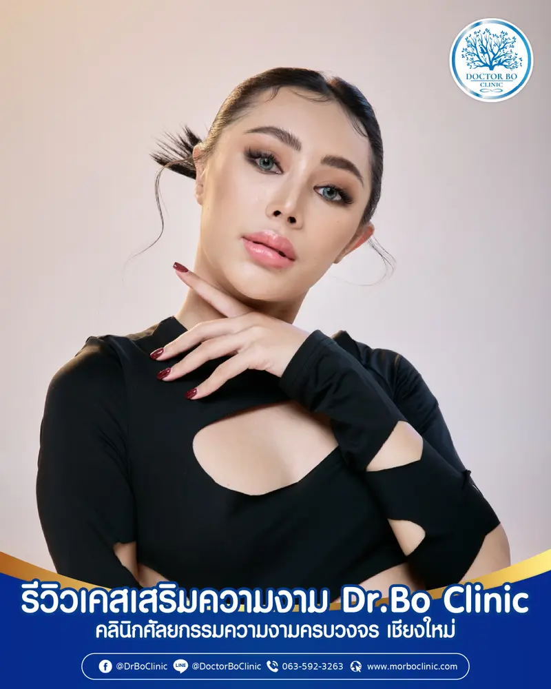 ภาพรีวิวเสริมความงาม | Dr.Bo Clinic คลินิกศัลยกรรมความงาม เชียงใหม่