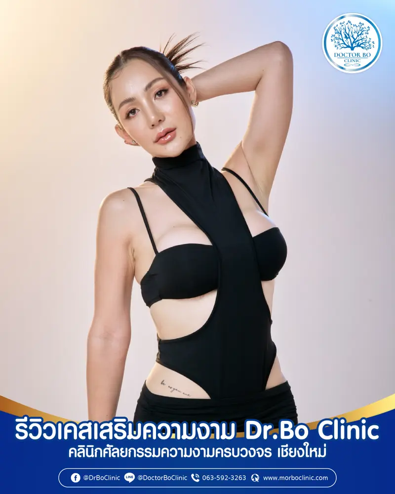 ภาพรีวิวเสริมความงาม | Dr.Bo Clinic คลินิกศัลยกรรมความงาม เชียงใหม่