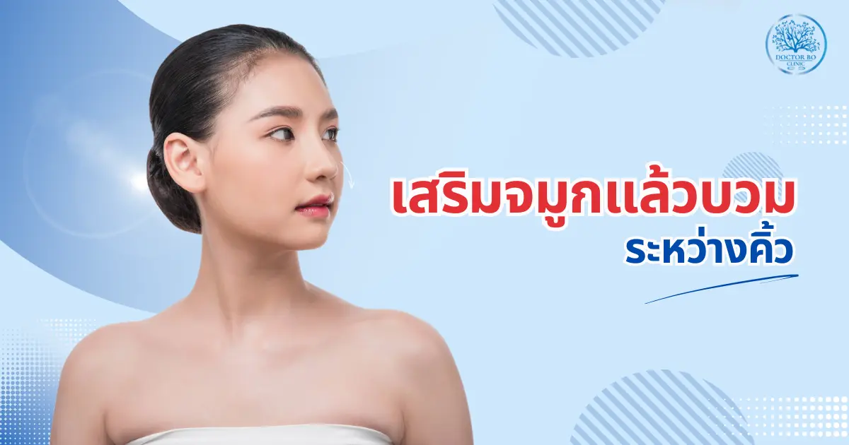 หลังจากเสริมจมูกแล้วบวมระหว่างคิ้ว รักษาอย่างไรให้หายเร็ว