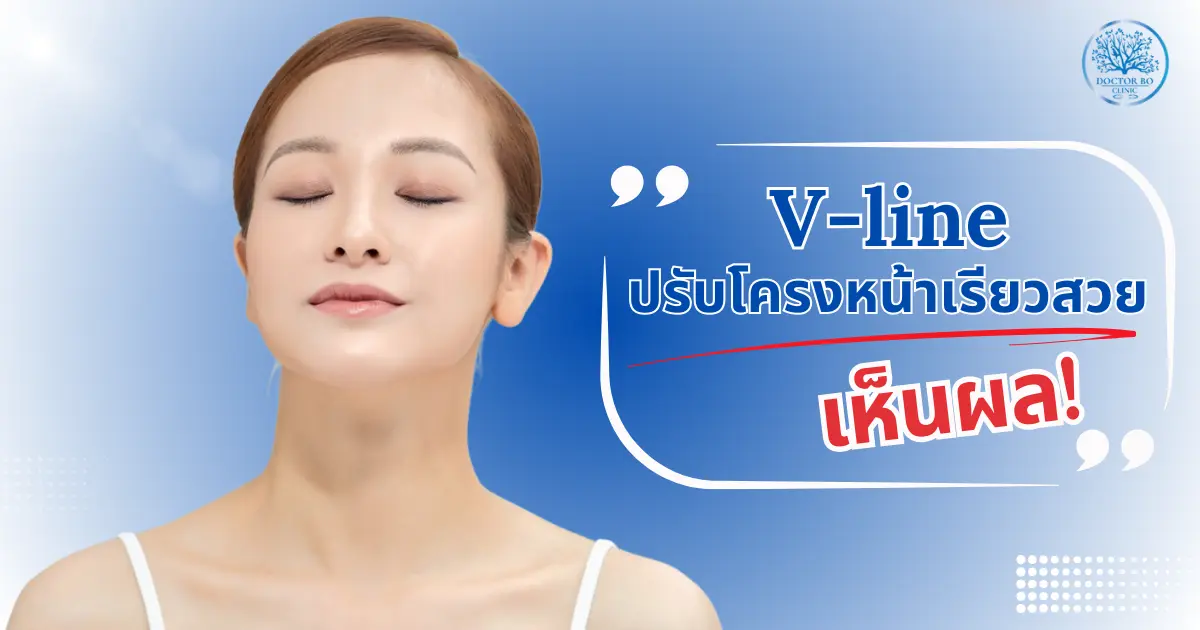 V-line เสริมคางทรงวีไลน์ เทคนิคเกาหลี ปรับโครงหน้าเรียวสวย ที่ Dr.Bo Clinic เชียงใหม่ 