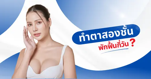 ทำตาสองชั้นพักฟื้นกี่วัน? เคล็ดลับฟื้นตัวเร็ว วิธีดูแลระหว่างฟื้นตัว