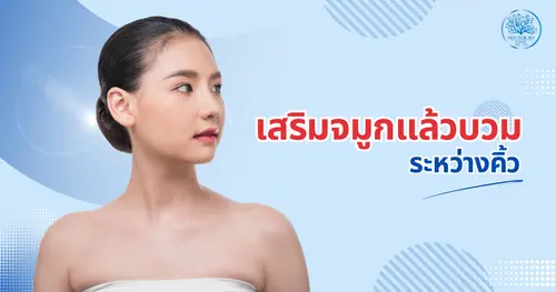 หลังจากเสริมจมูกแล้วบวมระหว่างคิ้ว รักษาอย่างไรให้หายเร็ว