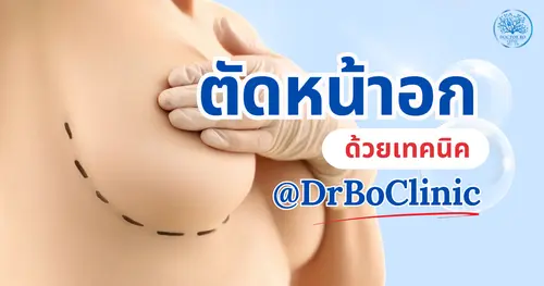ตัดหน้าอกกับหมอโบ ปลอดภัย ธรรมชาติ ด้วยเทคนิคเฉพาะตัว