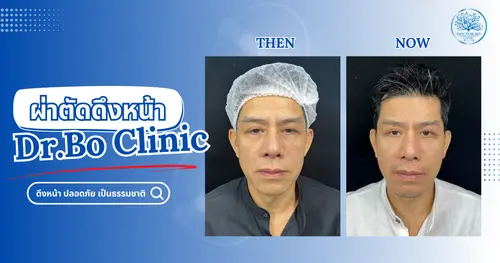 ผ่าตัดดึงหน้าที่ Dr.Bo Clinic เชียงใหม่ – บริการปลอดภัยเพื่อผลลัพธ์ที่ดูเป็นธรรมชาติ