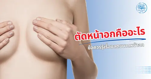 ตัดหน้าอกคืออะไร? ทุกเรื่องที่ควรรู้เกี่ยวกับการศัลยกรรมลดขนาดหน้าอก