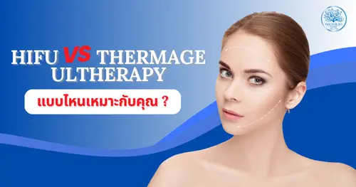 เปรียบเทียบเทคนิคยกกระชับหน้า HIFU, Thermage และ Ultherapy – แบบไหนเหมาะกับคุณ?