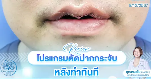 รีวิวปากกระจับ หมอโบ เชียงใหม่ สวยเป๊ะ ปลอดภัยแน่นอน