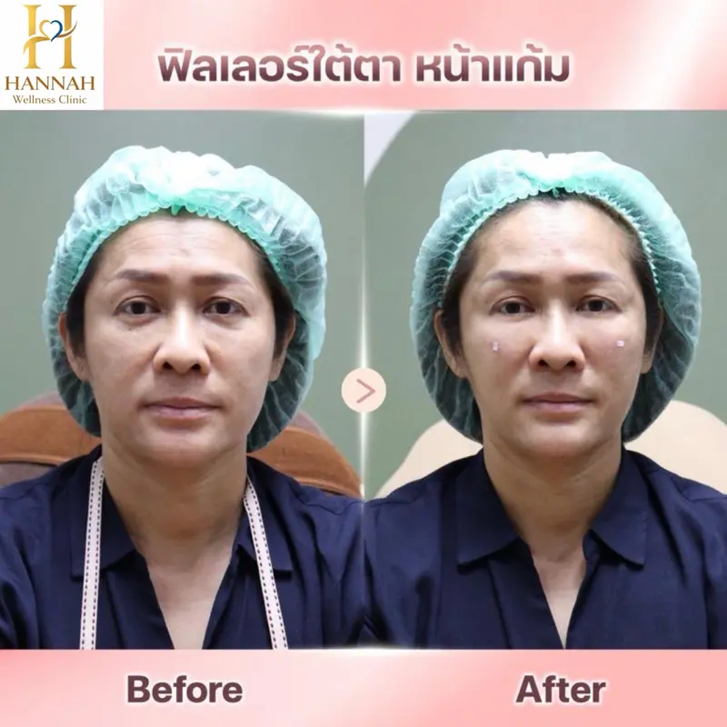 ปรับรูปหน้าแบบองค์รวม