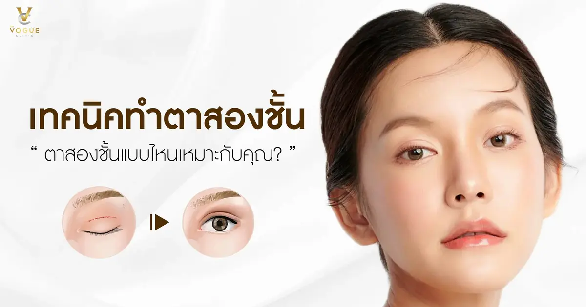 ตาสองชั้นแบบไหนเหมาะกับคุณ?