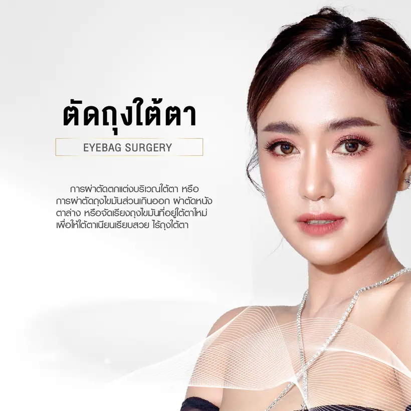ตัดถุงใต้ตา