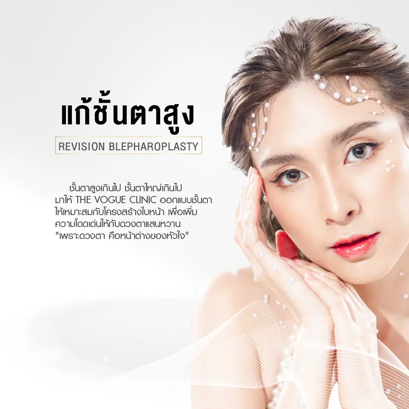 แก้ชั้นตาสูง