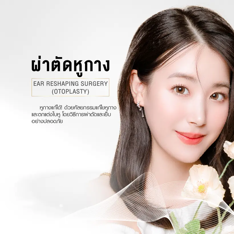 ผ่าตัดหูกาง