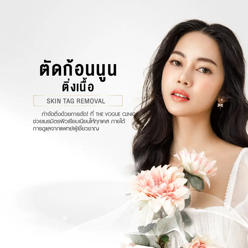 ตัดก้อนนูน ติ่งเนื้อ