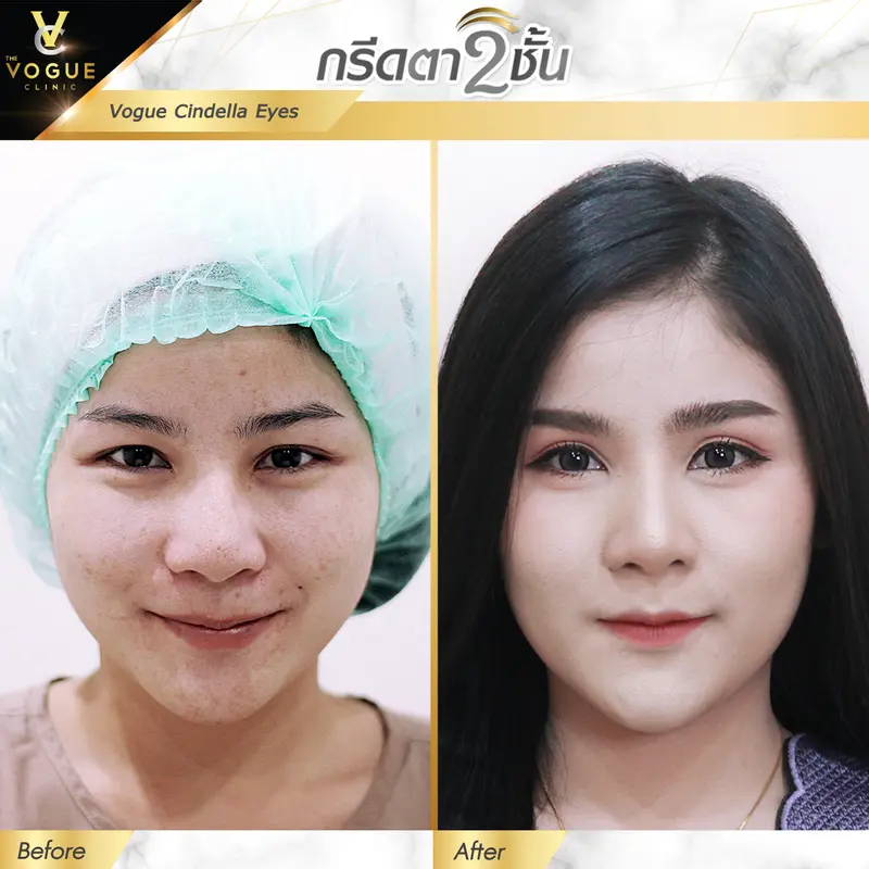 ตา2ชั้น ชลบุรี