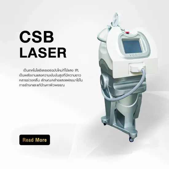 CSB Laser 