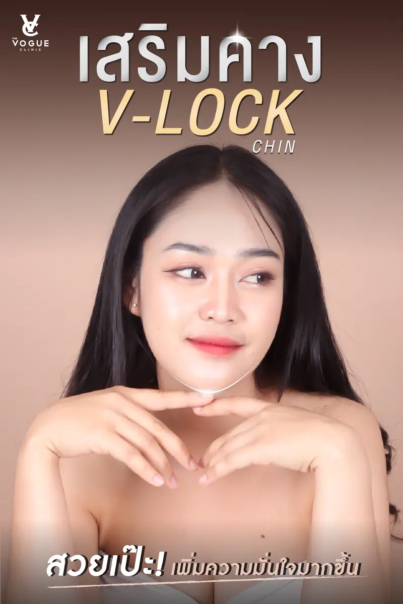 เสริมคาง