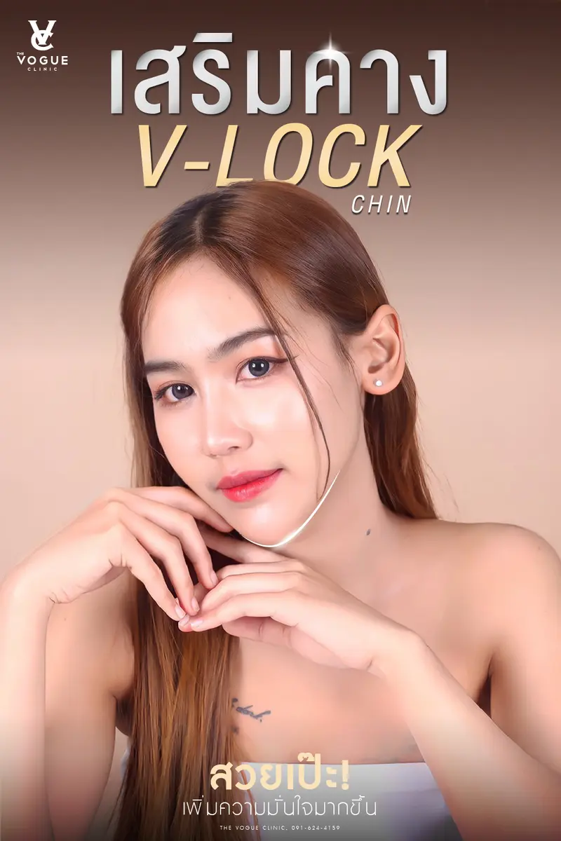 เสริมคาง