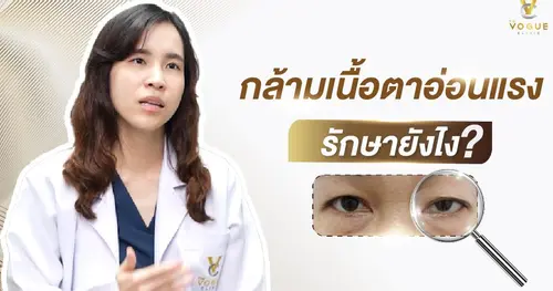 กล้ามเนื้อตาอ่อนแรงคืออะไร รักษายังไง
