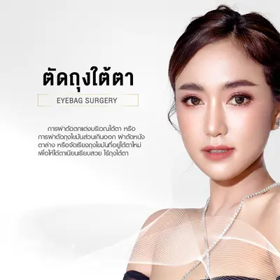 ตัดถุงใต้ตา