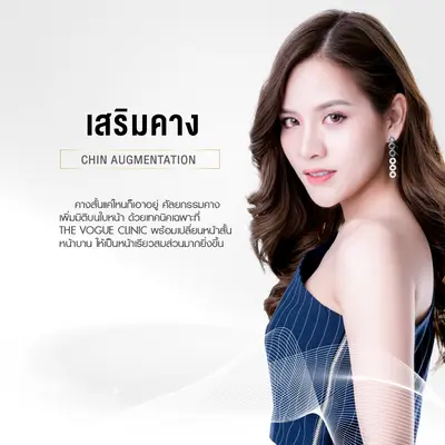 เสริมคาง