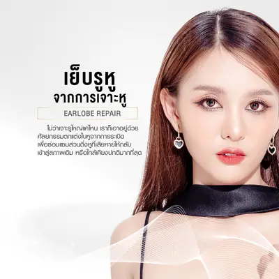 เย็บรูหูจากการเจาะหู