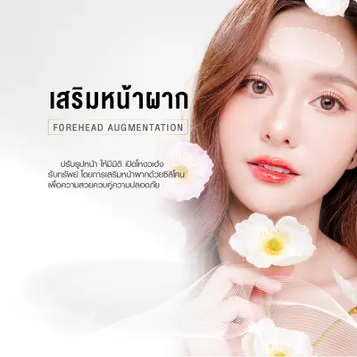 เสริมหน้าผาก