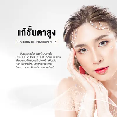แก้ชั้นตาสูง