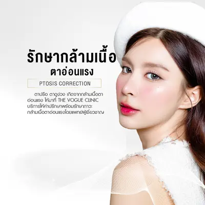 รักษากล้ามเนื้อตาอ่อนแรง