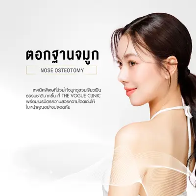 ศัลยกรรมตอกฐานจมูก