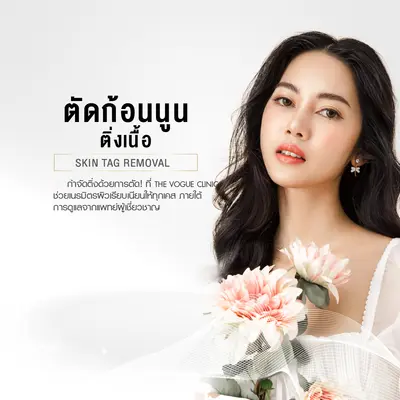 ตัดก้อนนูน ติ่งเนื้อ
